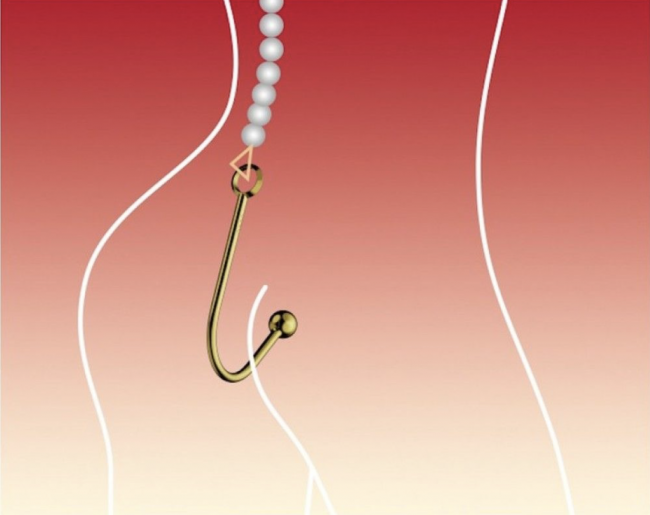   UPKO Hook    